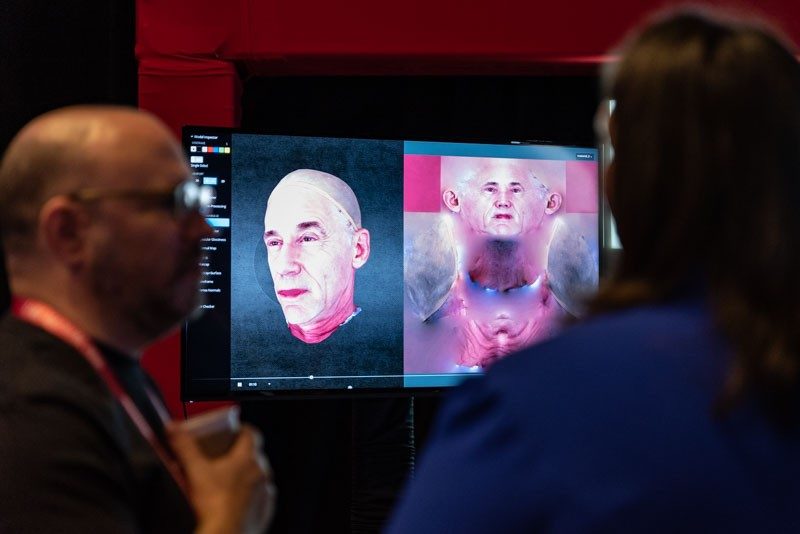 Brain Computer Interfaces; in a world where Artificial Intelligence exceeds human capacity, how do we upgrade humans?